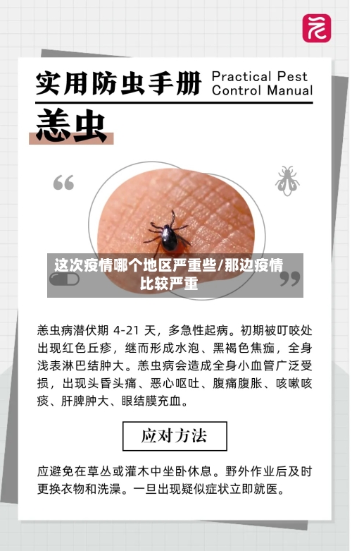 这次疫情哪个地区严重些/那边疫情比较严重